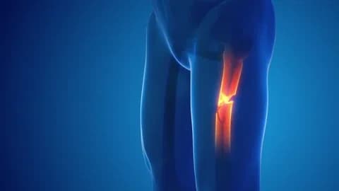 علاج كسور العظام