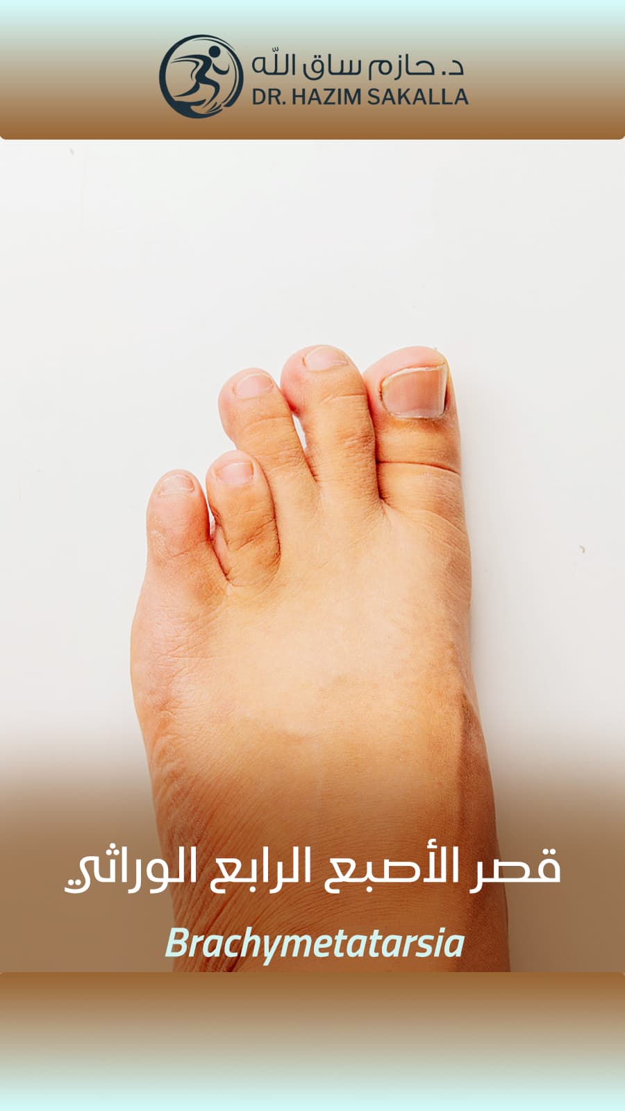 جراحة ترميمية جراحة ترميمية - نتائج تجميلية ووظيفية ممتازة | د. حازم ساق الله الرياض