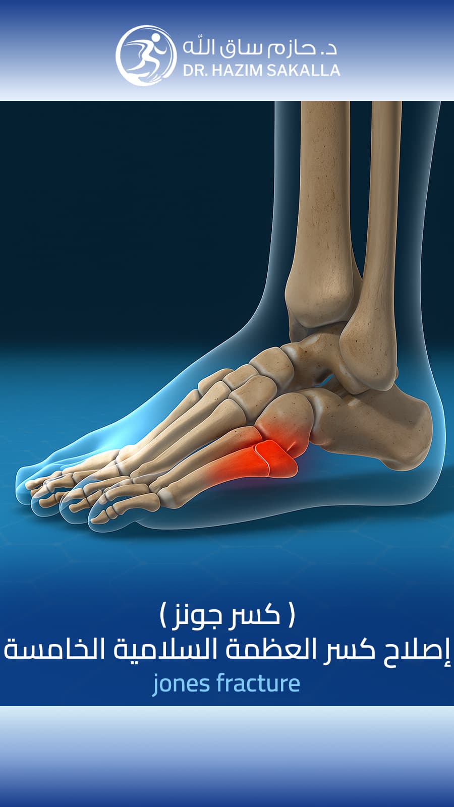 ترميم القدم والكاحل